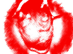 16504m30ateromeps 16504m30ateromeps